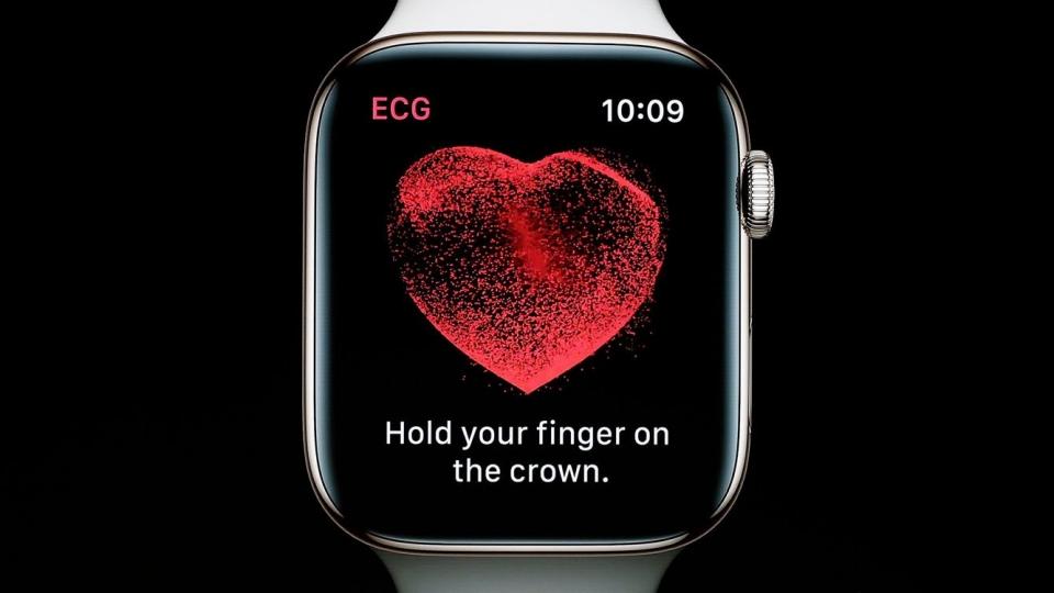 Apple Watch ecg
